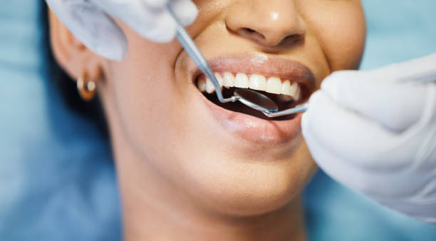 Best Emergency Dental Care for Broken or Chipped Teeth in Cassville, WV
